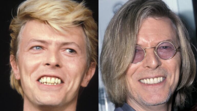 David Bowie: Cirugías, Mitos y Realidades