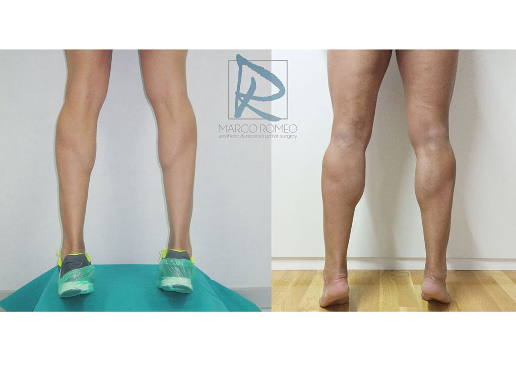 Precios de Cirugía en EE. UU.: Lo que Debes Saber