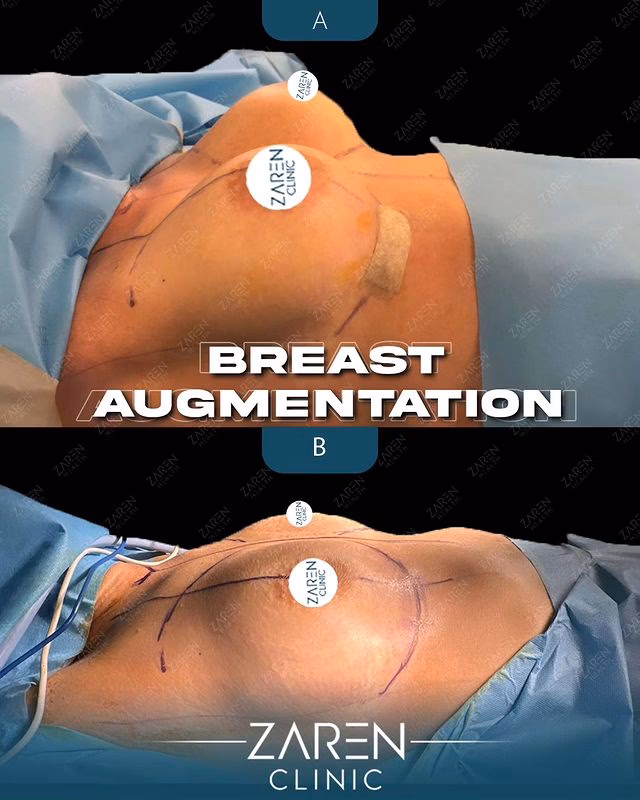 ¿Qué palabras eliminó la RAE?