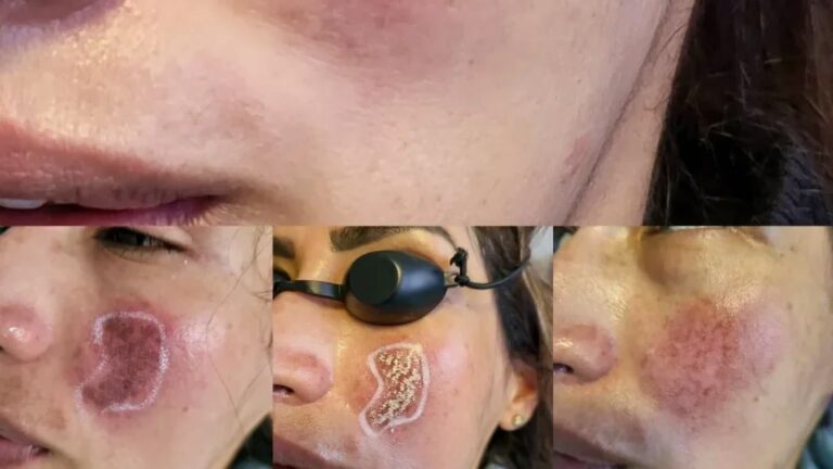 Duración de la Cirugía Facial: Mitos y Realidades