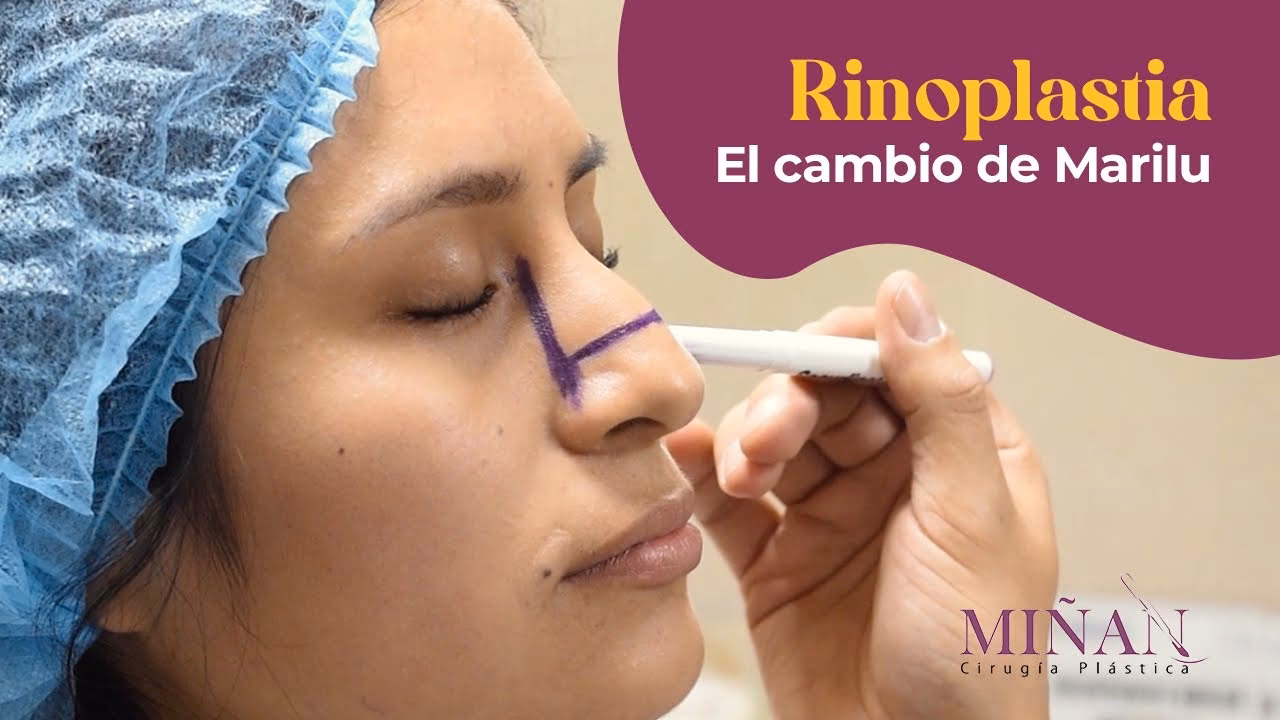 ¿Cuánto cuesta operarse la nariz en Lima, Perú?