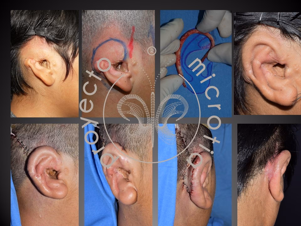 Riesgos de la Otomodelación: Lo que Debes Saber