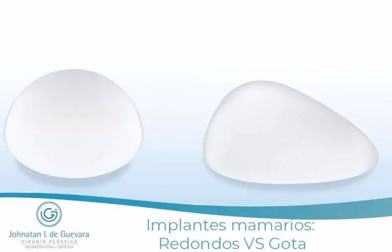 Implantes Mamarios en Gota: La Guía Definitiva