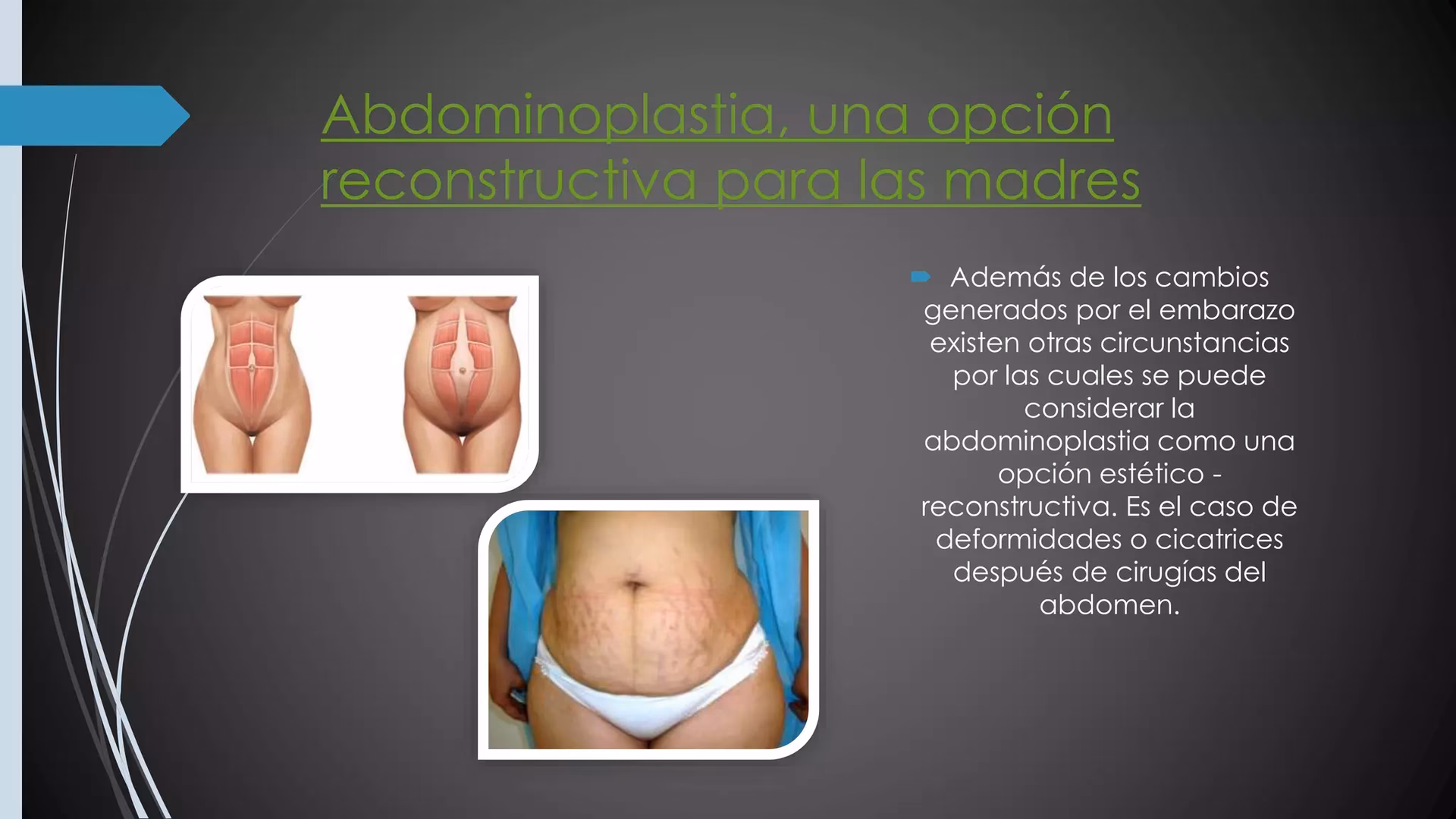 ¿Cuánto tiempo dura la recuperación de una dermolipectomia?