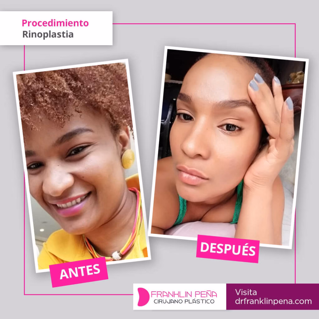 ¿Quién es Franklin Peña?