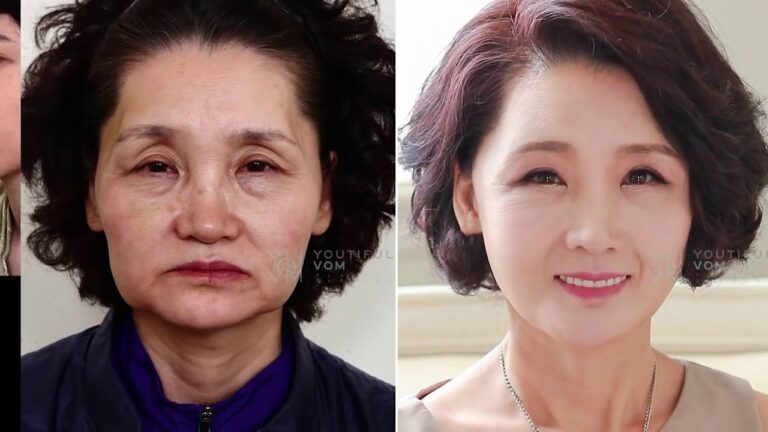 Cirugía Plástica en Corea del Norte: ¿Mito o Realidad?