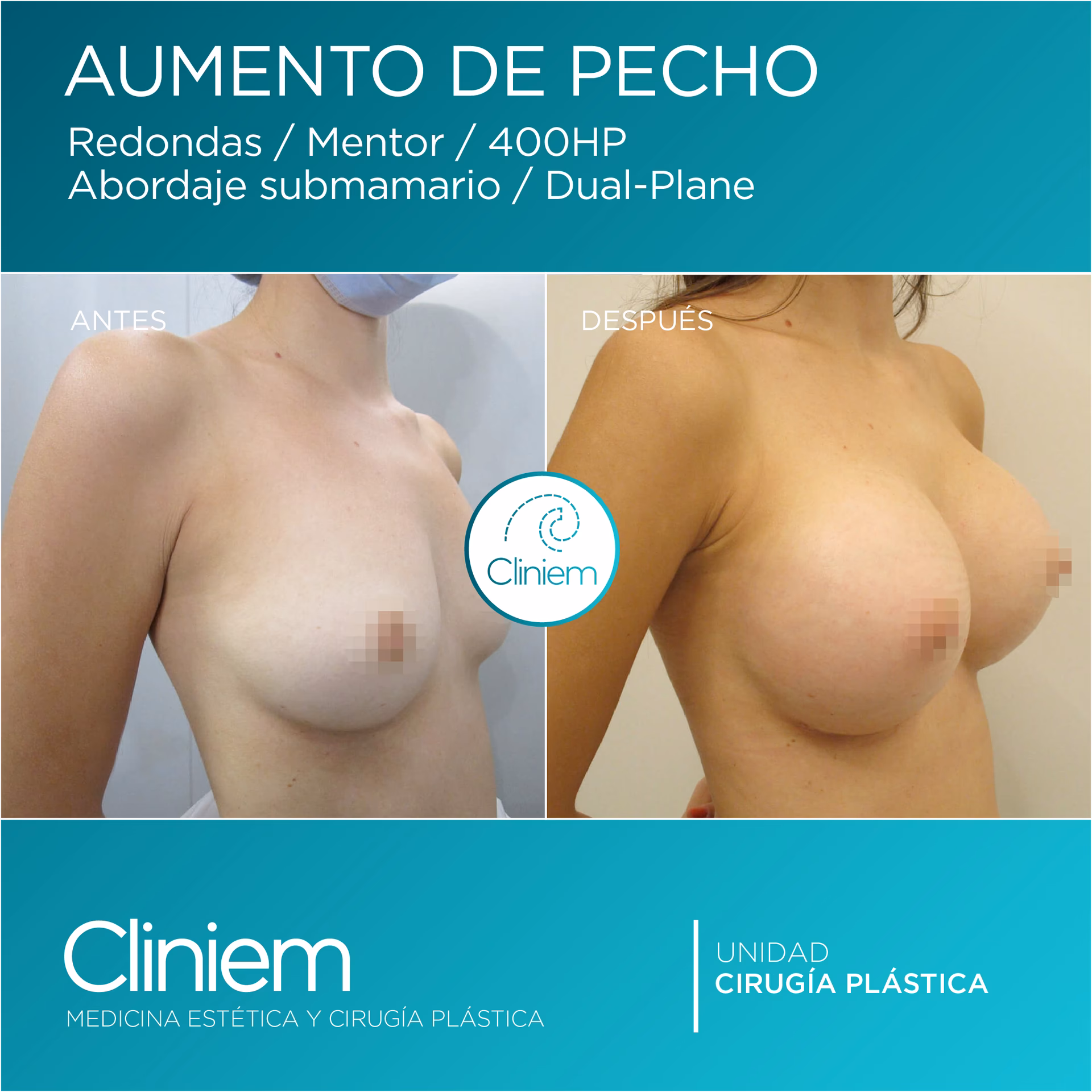 ¿Qué cirugías hace un cirujano de tórax?