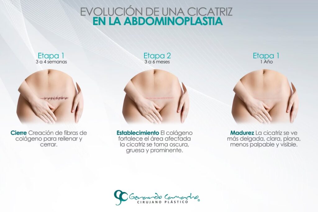 El Viaje Quirúrgico: Sus 5 Etapas Esenciales