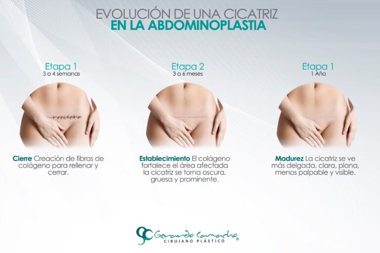 El Viaje Quirúrgico: Sus 5 Etapas Esenciales