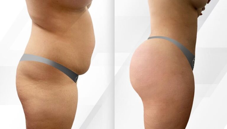 Descubre la Cirugía de Menor Costo: Un Análisis