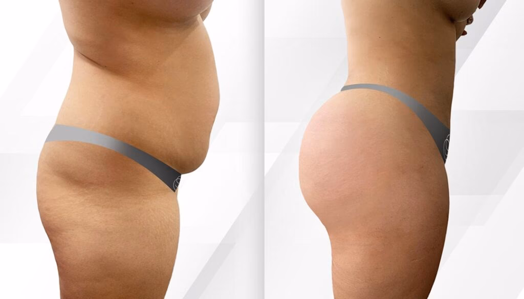 Descubre la Cirugía de Menor Costo: Un Análisis