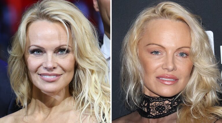 Madonna y el Rumor del Aumento de Glúteos (BBL)