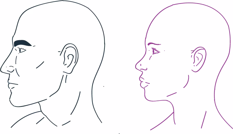 ¿Se puede limar el hueso de la frente?