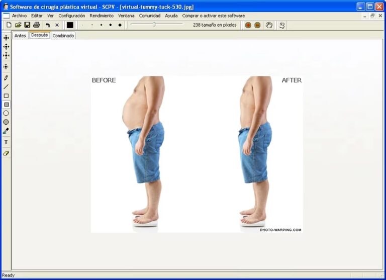 Rejuvenecimiento Facial: ¿La Mejor Cirugía?