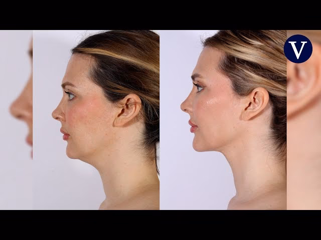 El Bisturí de las Estrellas: Cirugías Famosas