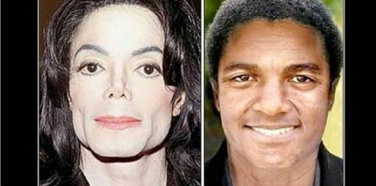 Michael Jackson: ¿Cuántas Cirugías Tuvo Realmente?