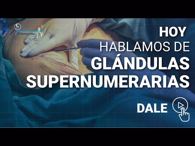 ¿Cómo eliminar la mama supernumeraria?