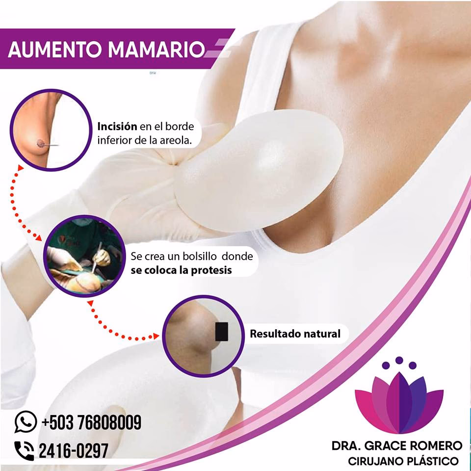 ¿Cuál es la diferencia entre mamoplastia y mastopexia?