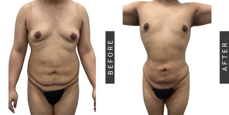 Mickey Rourke: El Rostro Reconstruido por el Boxeo