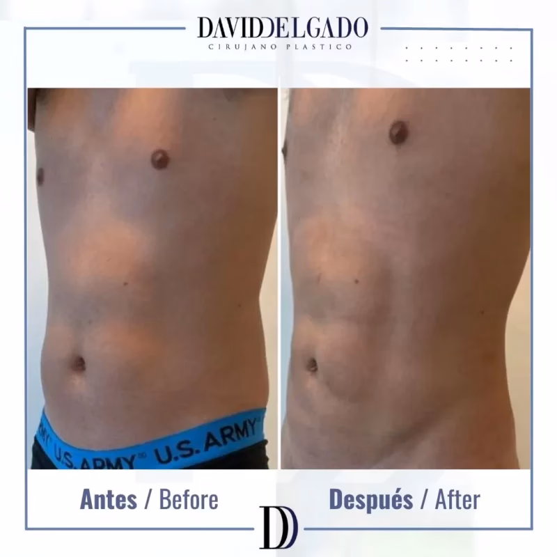 ¿Cuál es el mejor cirujano plástico en Medellín?