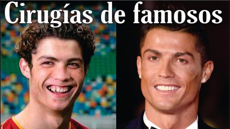 Rinoplastia en Famosos: Historias y Lecciones