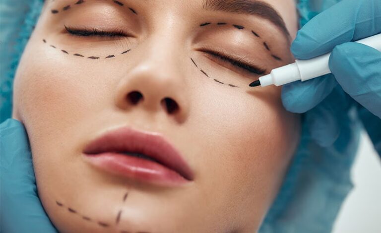 Oculoplastia: Más Allá de la Estética Ocular