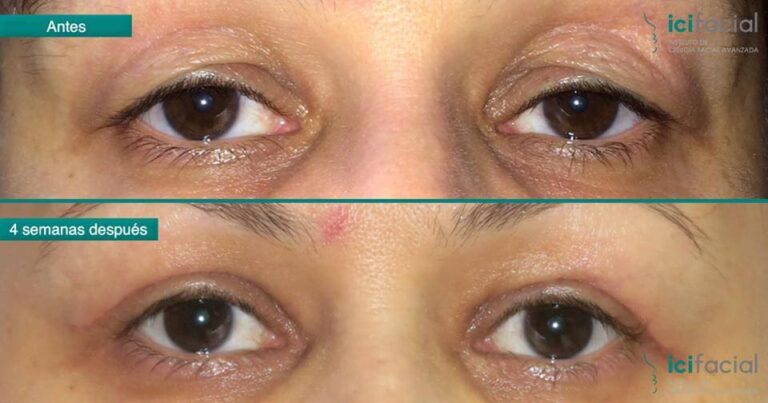 Oftalmología en España: Los Mejores de 2022