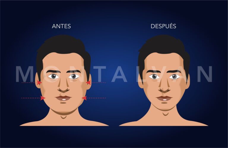 Adelgaza tu Rostro: Guía de Cirugía Facial