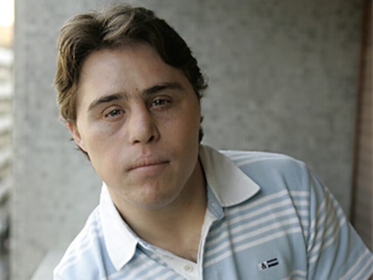 Armonización Facial: Más Allá de la Estética