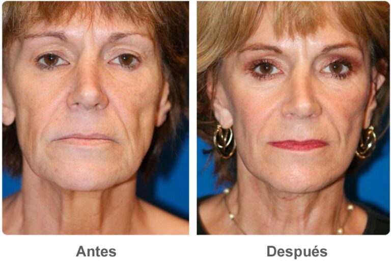 ¿Necesito Cirugía Plástica para Ser Bella?