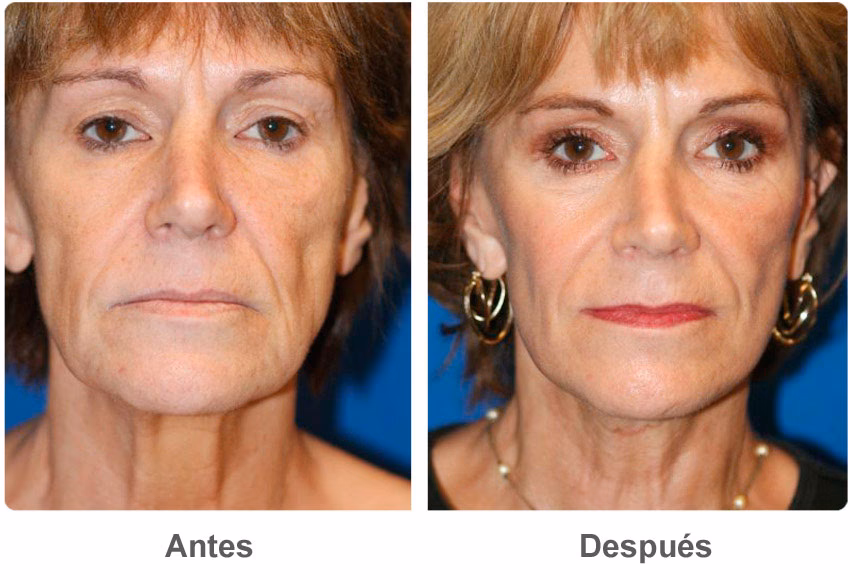 ¿Necesito cirugía plástica para ser guapa?