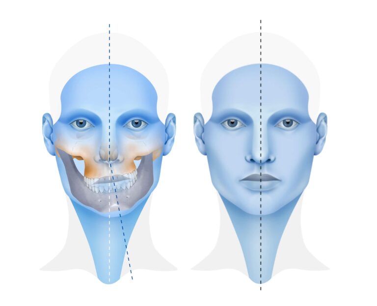 Cirugía de Simetría Facial: Guía Completa