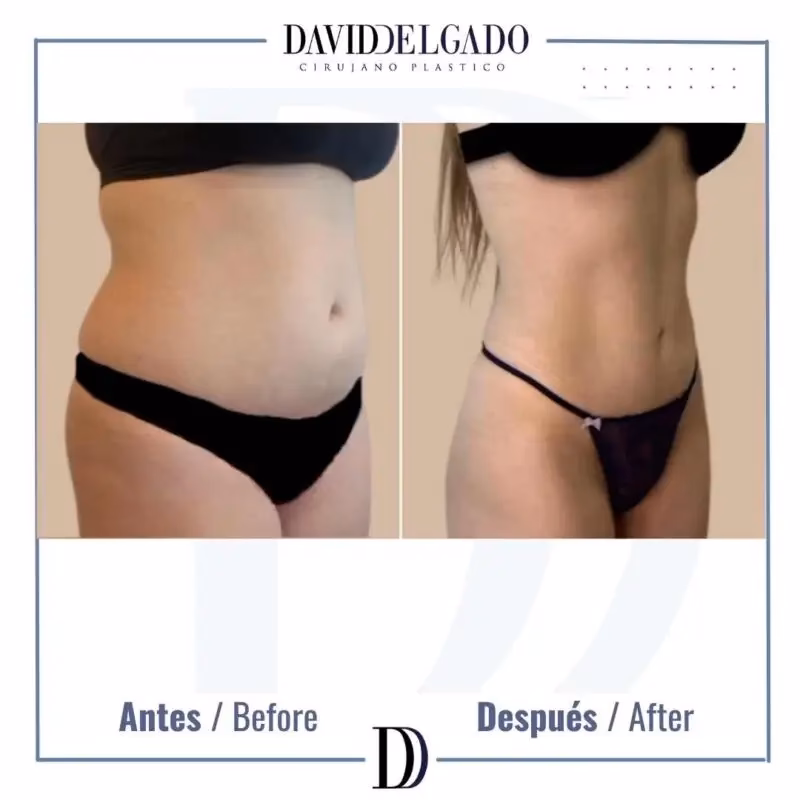 ¿Qué se considera cirugía de tejidos blandos?