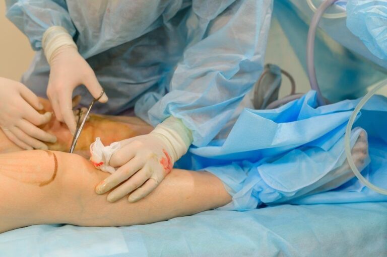 Cirugía de Tejidos Blandos: Guía Completa