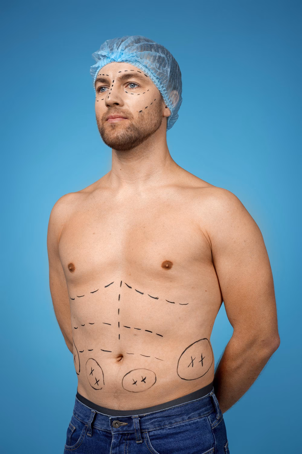 ¿Existe alguna cirugía para eliminar las pecas?