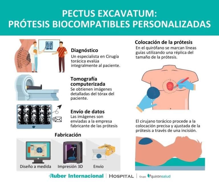 Costo y Detalles de la Cirugía de Pectus Excavatum
