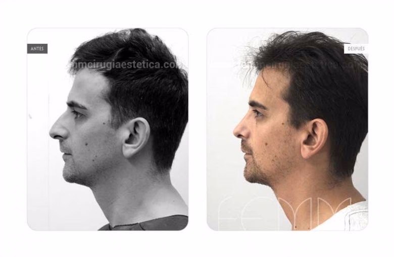 ¿Perfil de ingreso de un médico cirujano?