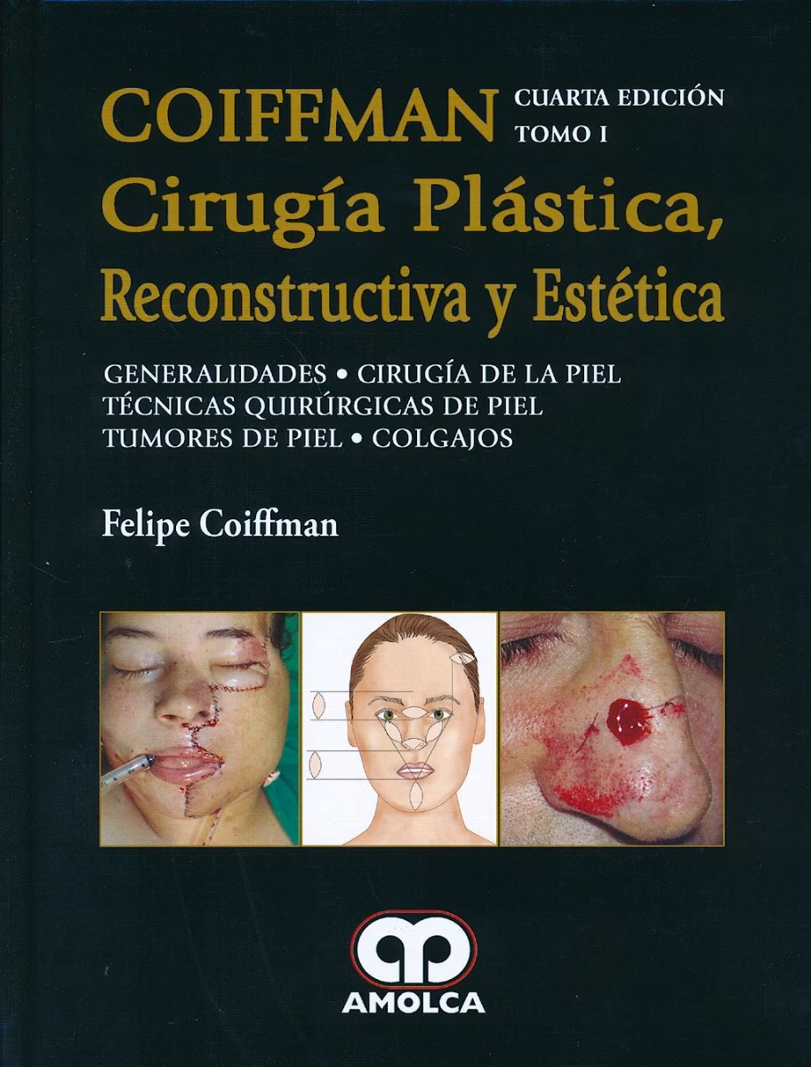 ¿IOMA cubre cirugias esteticas?