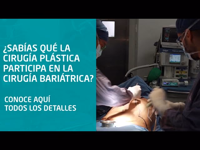 Cirugía Bariátrica: ¿Cuál es la Mejor para Ti?