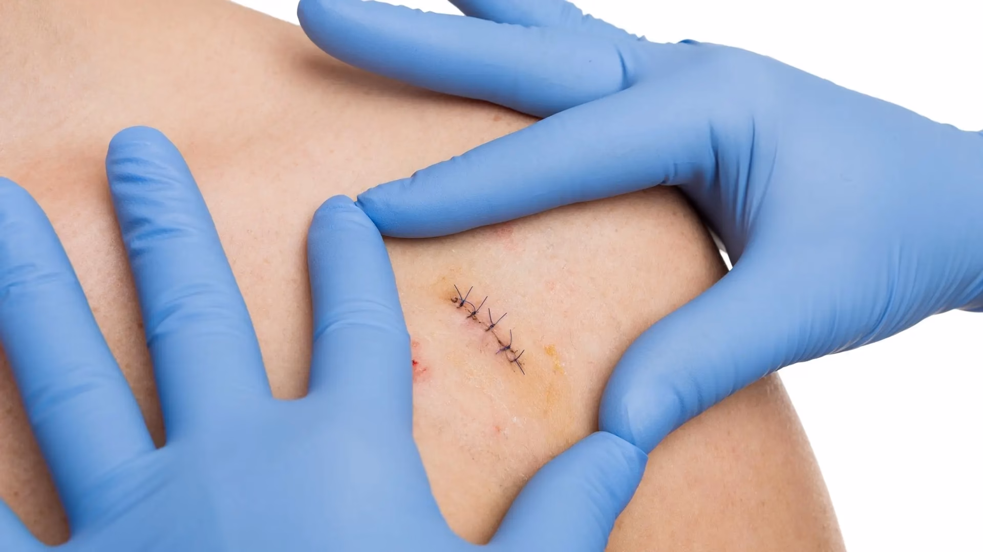 ¿Cuál es la diferencia entre cirugía funcional y estética?