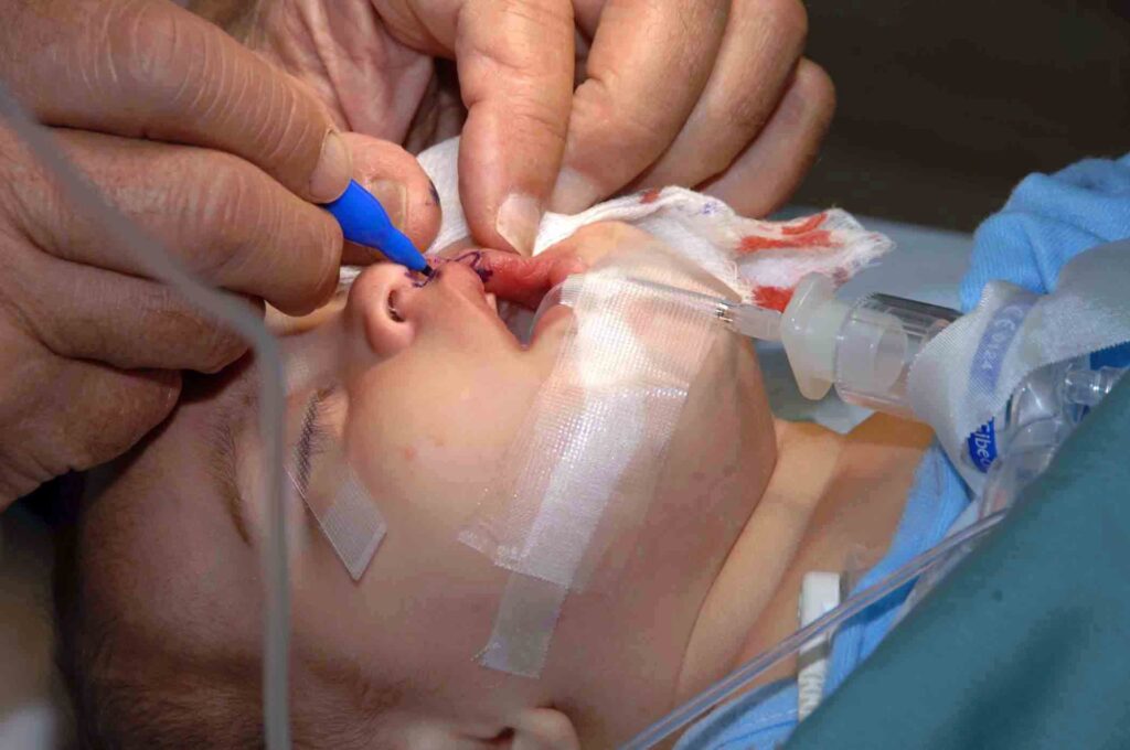 Cirugía Reparadora: Restaurando Forma y Función