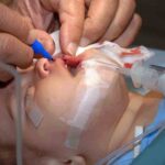 Cirujanos Plásticos y el Cuidado de Heridas