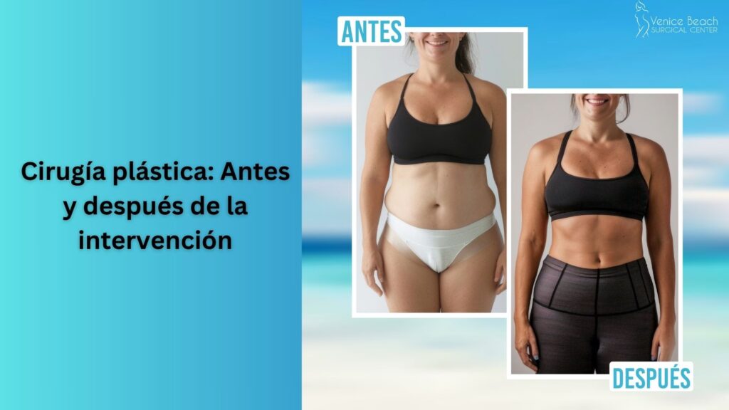 Tiempos de Recuperación Quirúrgica: Una Guía Real