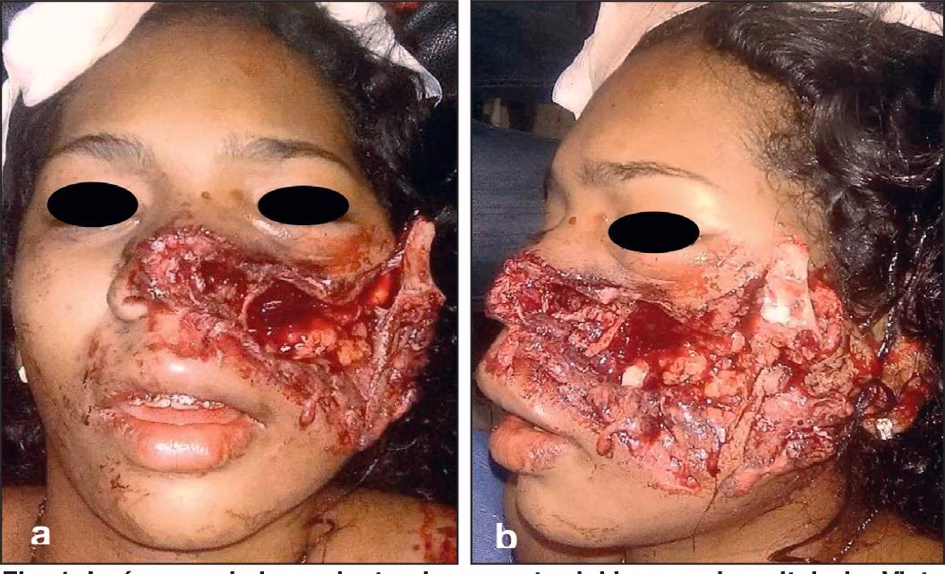 ¿Qué es la cirugía del trauma?