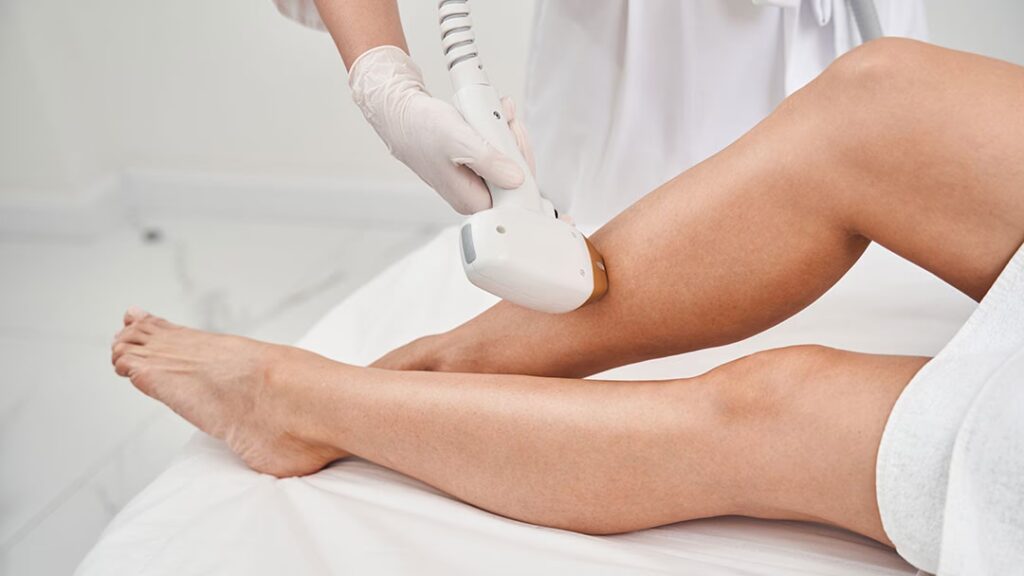 Depilación Láser: ¿Cuándo No Es Recomendable?
