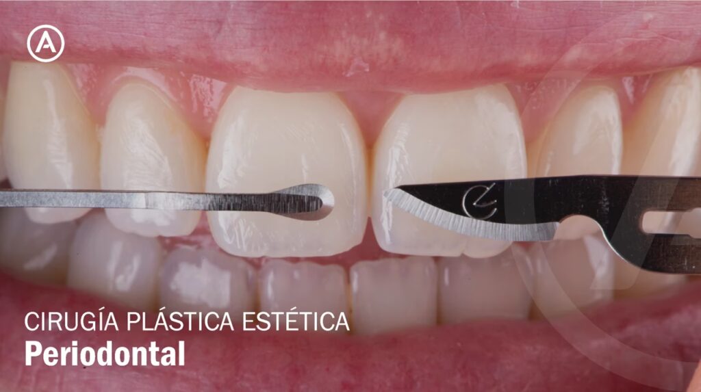 Cómo ser Periodoncista: Guía Completa de Estudios