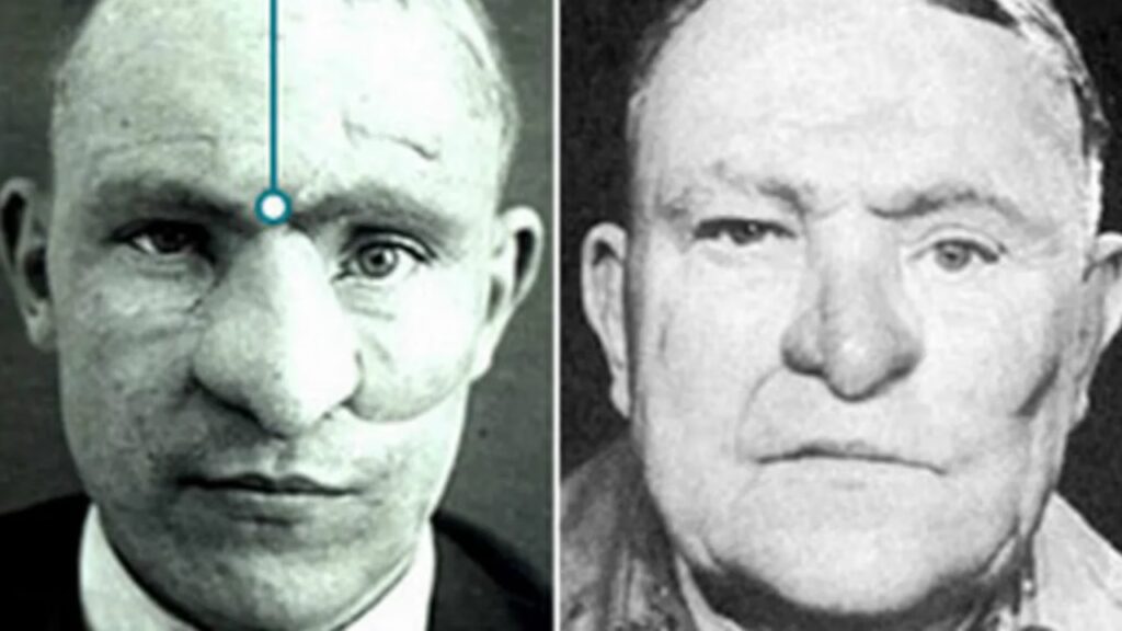 Cirugía Plástica: Nacida en la Gran Guerra