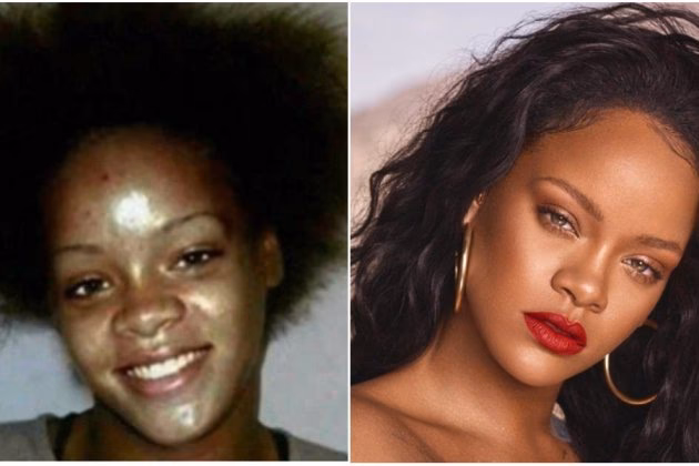 ¿Qué cirugías se ha realizado Rihanna?