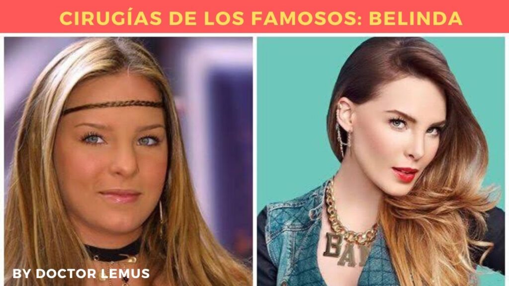 La Lesión de Belinda: ¿Qué le Pasó en la Rodilla?