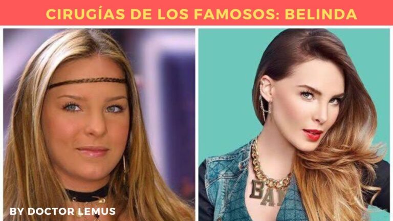 La Lesión de Belinda: ¿Qué le Pasó en la Rodilla?